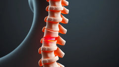 Übungsleser aufgepasst: effektive Übungen bei einem bandscheibenvorfall lendenwirbelsäule